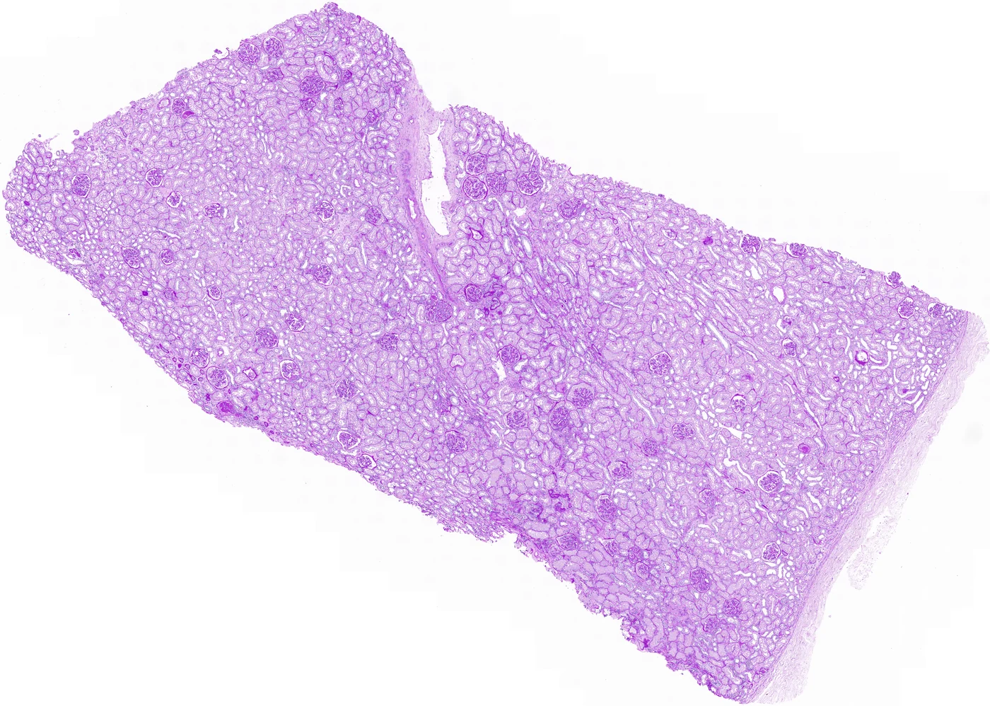A scanned kidney biopsy with its full tissue section visible.